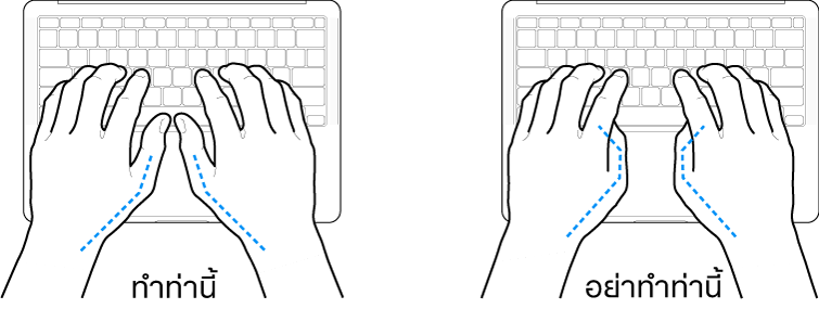 มือวางอยู่เหรือแป้นพิมพ์ แสดงตำแหน่งการวางนิ้วหัวแม่มือที่ถูกต้องและไม่ถูกต้อง