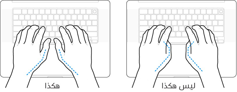 يدان موضوعتان على لوحة مفاتيح، ويظهر الوضع الصحيح وغير الصحيح للإبهامين.