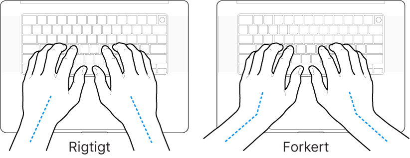 Hænder anbragt over et tastatur med rigtig og forkert position af håndled og hånd.