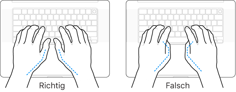 Tastatur und Hände in richtiger und falscher Haltung der Daumen