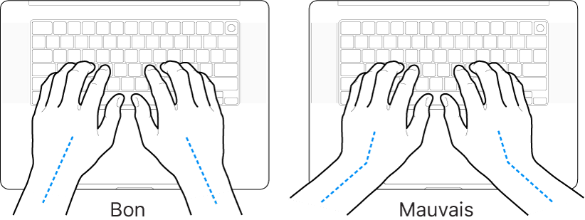 Mains placées sur un clavier, montrant le bon et le mauvais alignement des poignets et des mains.