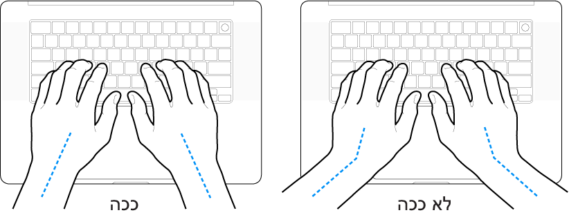 ידיים מעל מקלדת, להדגמת מנח נכון ומנח שגוי של כף היד ושורש כף היד.