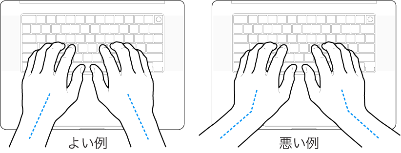 キーボードに置かれた手。手首と手の適切な位置関係と不適切な位置関係を示しています。