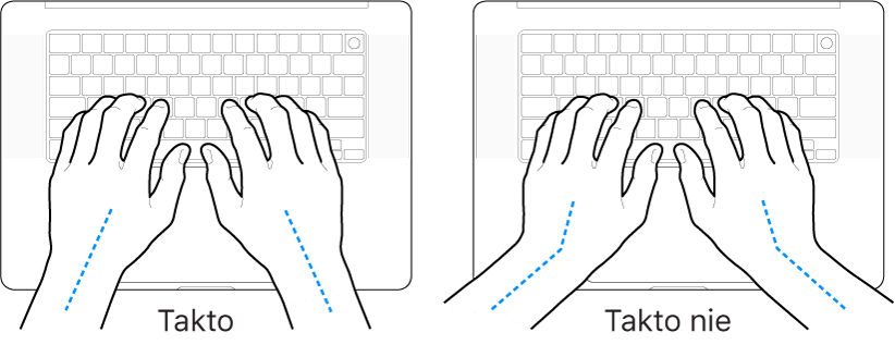Ruky položené na klávesnici znázorňujúce správnu a nesprávnu polohu zápästia a ruky.