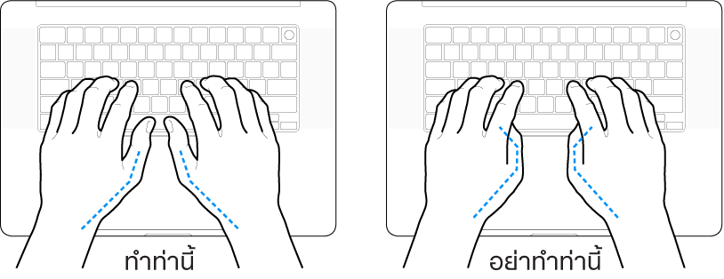 มือวางอยู่เหรือแป้นพิมพ์ แสดงตำแหน่งการวางนิ้วหัวแม่มือที่ถูกต้องและไม่ถูกต้อง