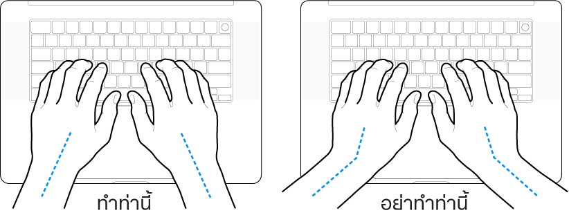 มือวางอยู่เหรือแป้นพิมพ์ แสดงตำแหน่งการวางข้อมือและแขนที่ถูกต้องและไม่ถูกต้อง