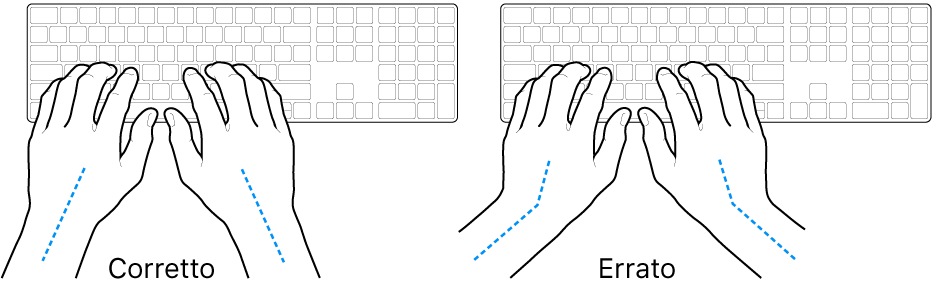 Mani posizionate su una tastiera che illustrano l'allineamento corretto ed errato di polso e mano.