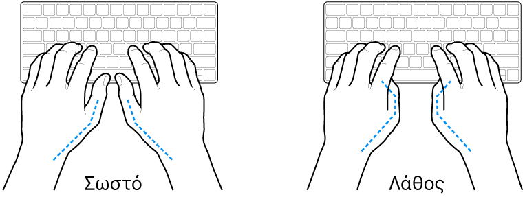 Χέρια τοποθετημένα επάνω σε ένα πληκτρολόγιο, που δείχνουν τη σωστή και τη λανθασμένη θέση των αντίχειρων.
