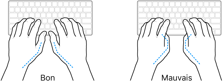 Mains placées sur un clavier, montrant la bonne et la mauvaise position des pouces.