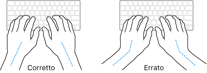 Mani posizionate su una tastiera che illustrano l'allineamento corretto ed errato di polso e mano.