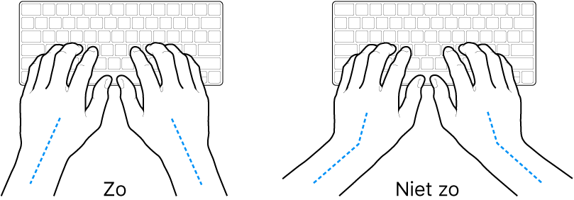 Handen boven een toetsenbord, waarbij de goede en verkeerde stand van de handen en polsen wordt aangegeven.