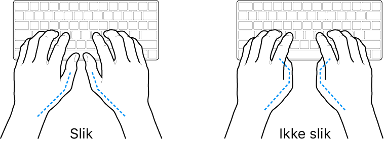 Hender plassert over et tastatur som viser riktig og feil tommelstilling.