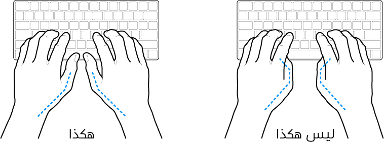 يدان موضوعتان على لوحة مفاتيح، ويظهر الوضع الصحيح وغير الصحيح للإبهامين.