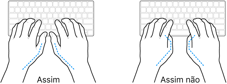 As mãos posicionadas sobre um teclado a mostrar a colocação correta e incorreta dos polegares.