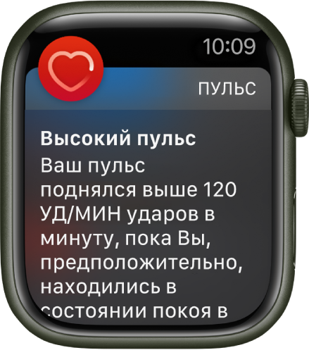 Как использовать часы apple watch. cdd1cb1e3b2d7d39c80391eb3fcac880. Как использовать часы apple watch фото. Как использовать часы apple watch-cdd1cb1e3b2d7d39c80391eb3fcac880. картинка Как использовать часы apple watch. картинка cdd1cb1e3b2d7d39c80391eb3fcac880