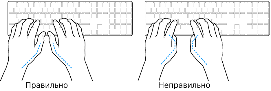 Руки розташовано над клавіатурою й показано правильне та неправильне положення великих пальців.