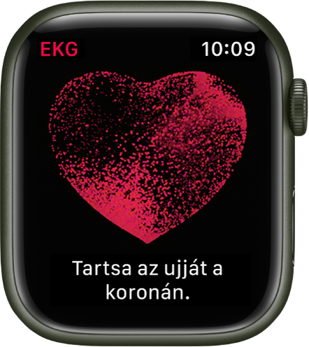 ekg apple