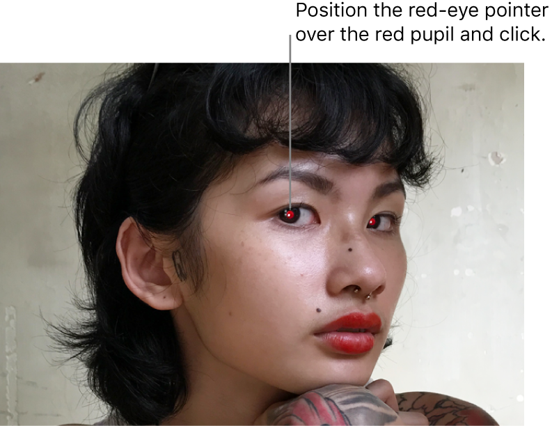 A photo of a person showing red pupils.