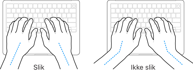 Hender plassert over et tastatur som viser riktig og feil stilling for håndledd og hender.