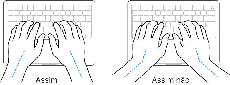 As mãos posicionadas sobre um teclado a mostrar alinhamentos corretos e incorretos das mãos e dos pulsos.