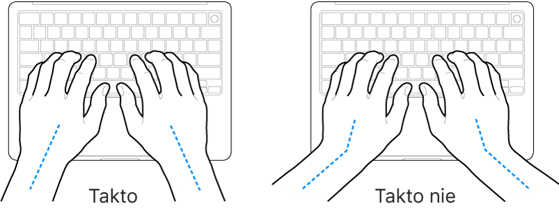 Ruky položené na klávesnici znázorňujúce správnu a nesprávnu polohu zápästia a ruky.