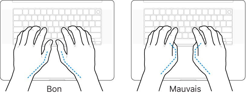 Mains placées sur un clavier, montrant la bonne et la mauvaise position des pouces.