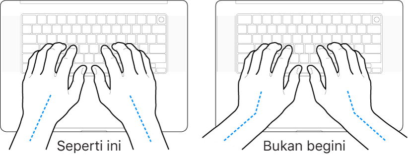 Tangan diposisikan di atas papan ketik, menampilkan penyejajaran pergelangan tangan dan tangan yang benar dan salah.
