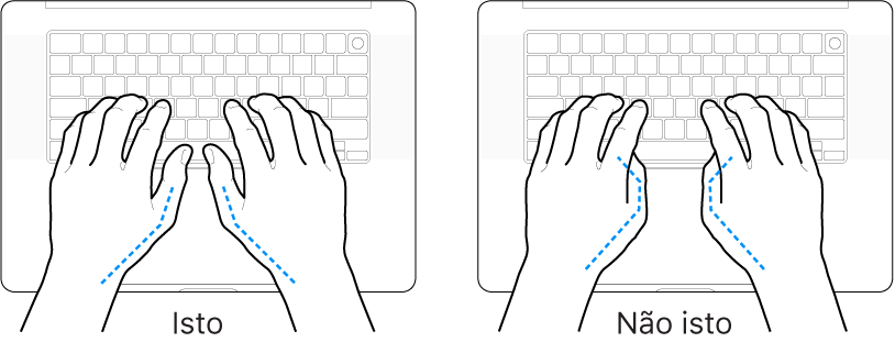 Mãos posicionadas sobre um teclado, mostrando os alinhamentos correto e incorreto dos polegares.