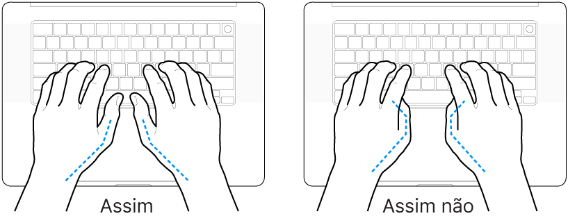 As mãos posicionadas sobre um teclado a mostrar a colocação correta e incorreta dos polegares.