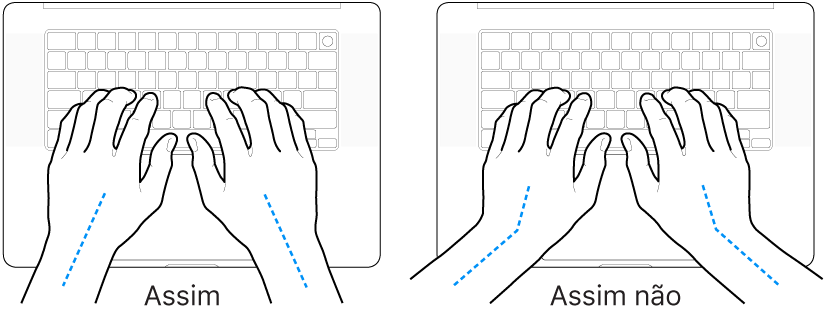 As mãos posicionadas sobre um teclado a mostrar alinhamentos corretos e incorretos das mãos e dos pulsos.