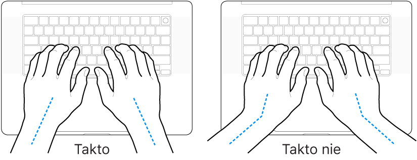 Ruky položené na klávesnici znázorňujúce správnu a nesprávnu polohu zápästia a ruky.