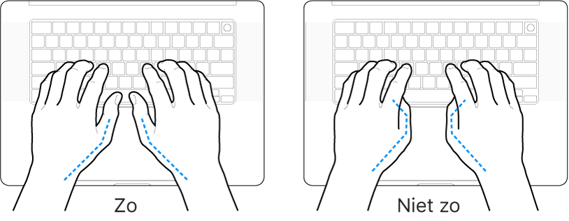 Handen boven een toetsenbord, waarbij de goede en verkeerde stand van de duimen wordt aangegeven.