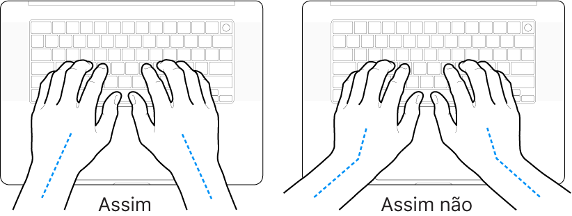 As mãos posicionadas sobre um teclado a mostrar alinhamentos corretos e incorretos das mãos e dos pulsos.