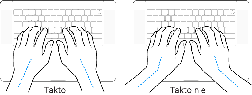 Ruky položené na klávesnici znázorňujúce správnu a nesprávnu polohu zápästia a ruky.