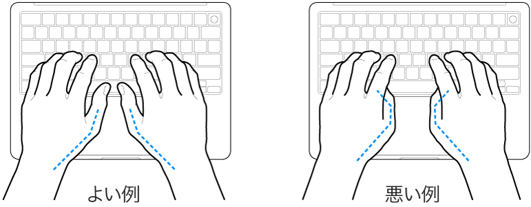 キーボードに置かれた手。親指の適切な位置と不適切な位置を示しています。