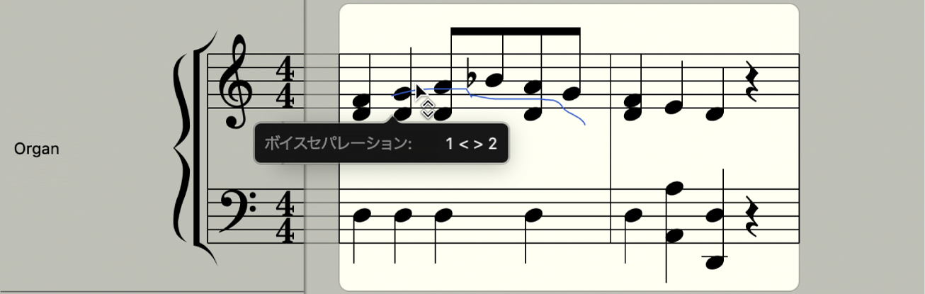 図。スコアエディタの2つの音符の間にあるボイス・セパレーション・ツール