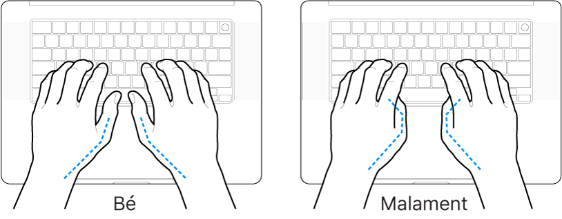 Unes mans posades sobre un teclat mostrant la posició correcta i incorrecta dels polzes.