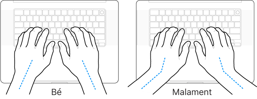 Unes mans posades sobre un teclat mostrant l’alineació correcta i incorrecta del canell i la mà.