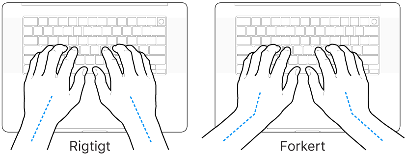 Hænder anbragt over et tastatur med rigtig og forkert position af håndled og hånd.