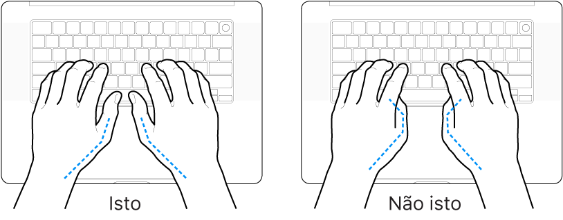 Mãos posicionadas sobre um teclado, mostrando os alinhamentos correto e incorreto dos polegares.