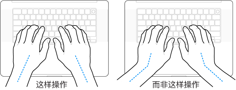 手掌放在键盘上方，显示手腕和手掌的正确对齐位置和错误对齐位置。