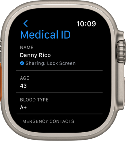 Екранът на Apple Watch за медицински ID, който показва името, възрастта и кръвната група на потребителя. Под името има отметка, показваща че медицински ID се споделя на заключен екран. Бутонът Done (Готово) е горе вляво.