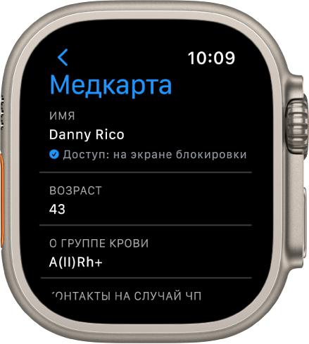 Экран Медкарты на Apple Watch, на котором показаны имя, возраст и группа крови пользователя. Под именем расположен флажок, указывающий, что к Медкарте предоставлен общий доступ на экране блокировки. В левом верхнем углу находится кнопка «Готово».