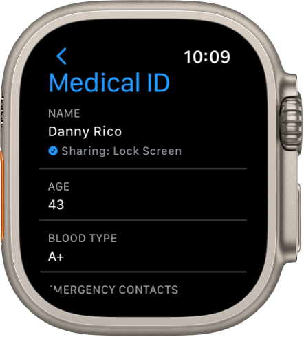 Zaslon Medical ID (Zdravstvena izkaznica) na Apple Watch, ki prikazuje uporabniško ime, starost in krvno skupino. Pod imenom je kljukica, ki označuje, da je funkcija Medical ID (Zdravstvena izkaznica) v skupni rabi na zaklenjenem zaslonu. V zgornjem levem kotu je prikazan gumb Done (Končano).