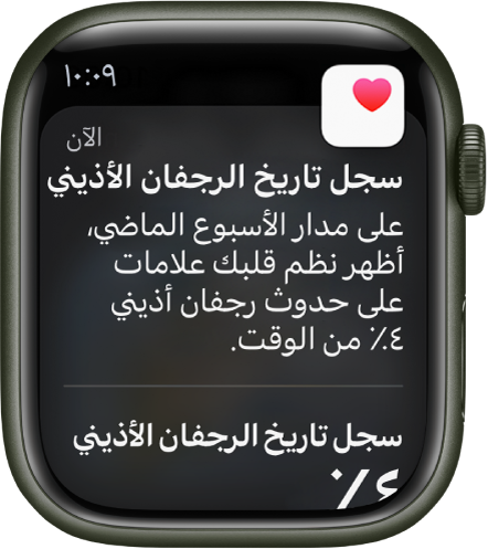 إشعار في سجل تاريخ الرجفان الأذيني يشير إلى وجود علامات بحدوث رجفان أذيني بنسبة 4 بالمائة من وقت الأسبوع الماضي.