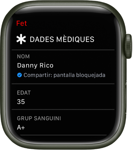Pantalla de dades mèdiques de l’Apple Watch amb el nom de l’usuari, l’edat i el grup sanguini. Hi ha una marca de verificació a sota del nom per indicar que les dades mèdiques s’estan compartint a la pantalla de bloqueig. A la part superior esquerra hi ha el botó Fet.