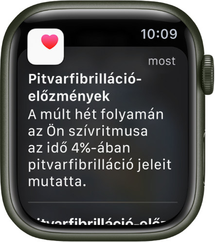 Pitvarfibrilláció-előzményekről szóló értesítés az Apple Watchon.