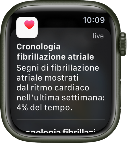 Una notifica della funzionalità “Cronologia fibrillazione atriale” su Apple Watch.