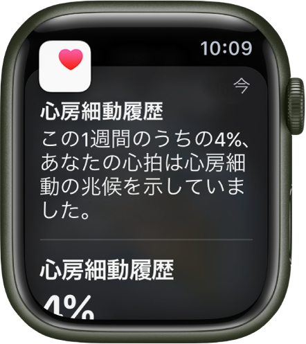Apple Watchの心房細動履歴の通知。