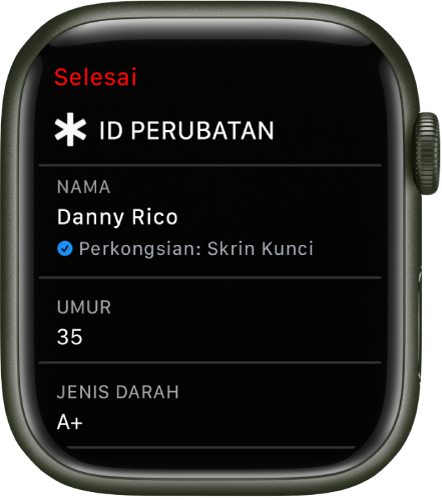 Skrin ID Perubatan pada Apple Watch menunjukkan nama, umur dan jenis darah pengguna. Tanda semak berada di bawah nama, menunjukkan bahawa ID Perubatan dikongsi pada skrin kunci. Butang Selesai berada di bahagian kiri atas.